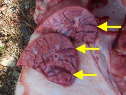 interlobular edema (arrows)